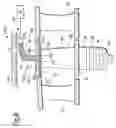 Fig. 07 - Apparatus to measure the clearance between a first component and a second component