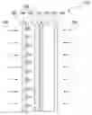 Fig. 01 - FILTER FOR DISPLAY DEVICE