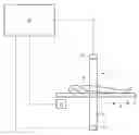 Fig. 01 - Method and apparatus for determining stress in an anatomical structure
