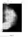 Fig. 02 - Method and system of providing a probability distribution to aid the detection of tumors in mammogram images