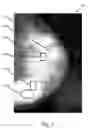 Fig. 02 - Voting in mammography processing