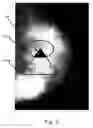 Fig. 06 - Voting in mammography processing