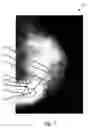 Fig. 08 - Voting in mammography processing