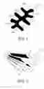 Fig. 02 - FIBER FOR WOUND DRESSING