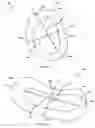 Fig. 05 - Bone matrix compositions and methods