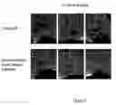 Fig. 06 - Bone matrix compositions and methods
