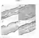 Fig. 07 - METHOD FOR PREVENTING OR TREATING EDEMA OR DERMATITIS USING GLEHNIA LITTORALIS FR. SCHMIDT ET MIQUEL EXTRACT
