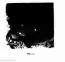 Fig. 03 - Medicament and method for treating recurrent spontaneous abortion
