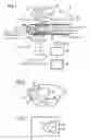 Fig. 02 - DEVICE FOR X-RAY BRACHYTHERAPY, AND METHOD FOR POSITIONING A PROBE INTRODUCED INTO A BODY FOR X-RAY BRACHYTHERAPY