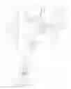 Fig. 01 - Contact sensor for fiberoptic raman probes