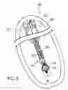 Fig. 04 - MARKER DEPLOYMENT DEVICE