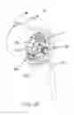 Fig. 16 - Deployment device interface for biopsy device