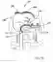 Fig. 32 - Deployment device interface for biopsy device