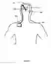 Fig. 02 - Method and apparatus for removing harmful proteins from a mammalian's ventricular cerebrospinal fluid