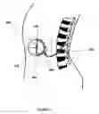 Fig. 04 - Method and apparatus for removing harmful proteins from a mammalian's ventricular cerebrospinal fluid