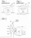 Fig. 02 - Devices and methods for reducing cardiac valve regurgitation