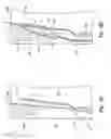 Fig. 04 - Systems and methods for transeptal cardiac procedures, including separable guidewires