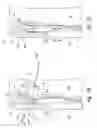 Fig. 08 - Systems and methods for transeptal cardiac procedures, including separable guidewires