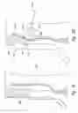 Fig. 11 - Systems and methods for transeptal cardiac procedures, including separable guidewires