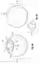 Fig. 07 - Pressure sensing intragastric balloon