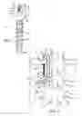 Fig. 02 - Bone anchor and spinal alignment system