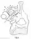 Fig. 04 - Vertebral fixing system