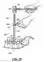 Fig. 07 - Method and apparatus for spinal facet joint fusion using irregularly shaped cortical bone implants