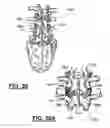 Fig. 09 - Method and apparatus for spinal facet joint fusion using irregularly shaped cortical bone implants