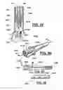 Fig. 26 - Method and apparatus for spinal facet joint fusion using irregularly shaped cortical bone implants