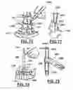 Fig. 28 - Method and apparatus for spinal facet joint fusion using irregularly shaped cortical bone implants