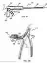 Fig. 07 - BONE SCREW SYSTEM AND METHOD
