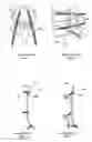 Fig. 02 - Expandable attachment device and method