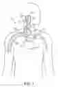 Fig. 02 - BAROREFLEX ACTIVATION THERAPY WITH CONDITIONAL SHUT OFF