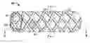 Fig. 01 - Stents with metallic covers and methods of making same
