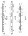 Fig. 03 - Stents with metallic covers and methods of making same
