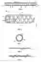 Fig. 04 - Stents with metallic covers and methods of making same