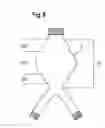 Fig. 09 - Vascular Prosthesis for Aneurysms, Set of Vascular Prostheses, Method for Manufacturing a Vascular Prosthesis and Method for Inserting a Vascular Prosthesis