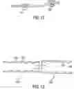 Fig. 07 - COMPOSITE STENT WITH INNER AND OUTER STENT ELEMENTS AND METHOD OF USING THE SAME