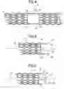 Fig. 06 - Bifurcated stenting appratus and method