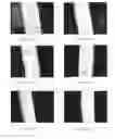 Fig. 10 - Method Of Modifying A Metal Substrate To Improve Surface Coverage Of A Coating
