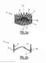 Fig. 06 - Valve prosthesis for implantation in body channels
