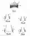 Fig. 07 - Valve prosthesis for implantation in body channels