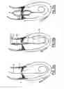 Fig. 13 - Valve prosthesis for implantation in body channels