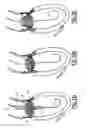 Fig. 16 - Valve prosthesis for implantation in body channels