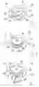 Fig. 06 - Apparatus and method for treating a regurgitant heart valve