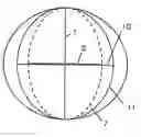 Fig. 01 - Astigmatic intraocular lens