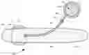 Fig. 01 - Prosthesis with bladder that adjusts girth