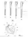 Fig. 02 - INSTRUMENT FOR USE IN A JOINT REPLACEMENT PROCEDURE