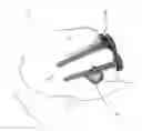 Fig. 06 - Implant for Use with an Osteotomy Plate