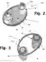 Fig. 03 - ANCHORING SYSTEMS AND INTERFACES FOR FLEXIBLE SURGICAL IMPLANTS  FOR  REPLACING CARTILAGE